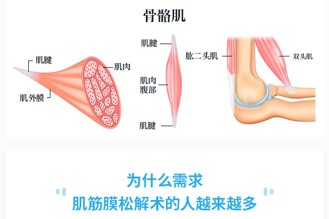 肌筋膜松懈术培训